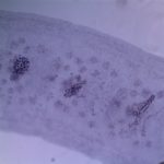 Testes (10x magnification)